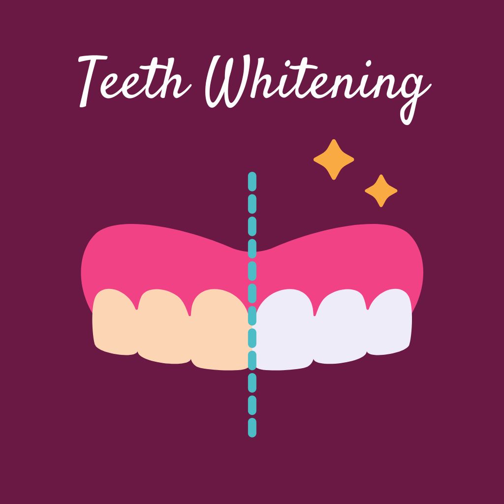 Teeth Whitening