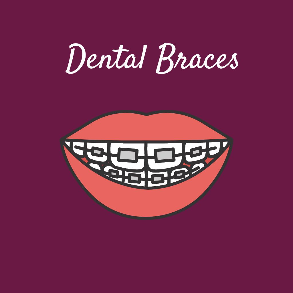 Dental Braces