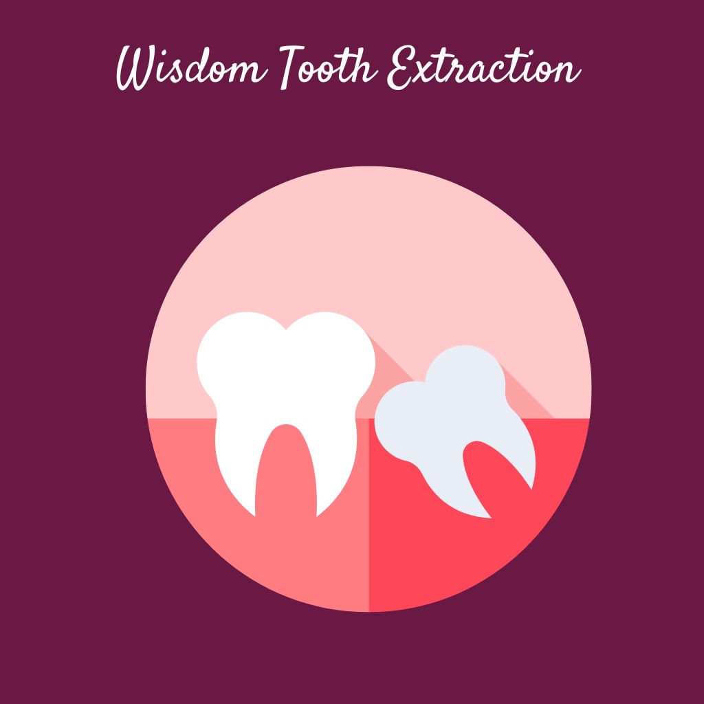 Wisdom Tooth Extraction