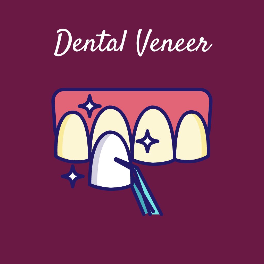 Dental Veneer