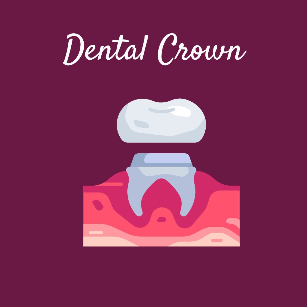 Dental Crown