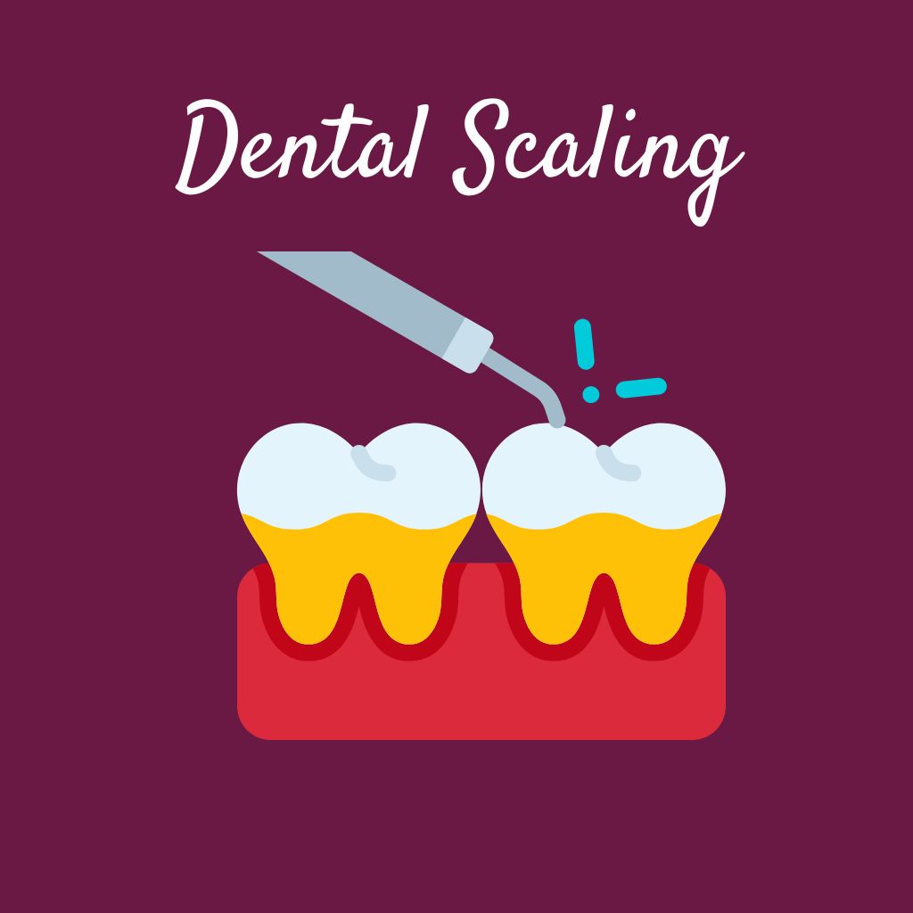 Dental Scaling