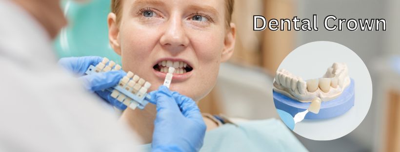 Dental Crown In Sanjay Nagar Bangalore