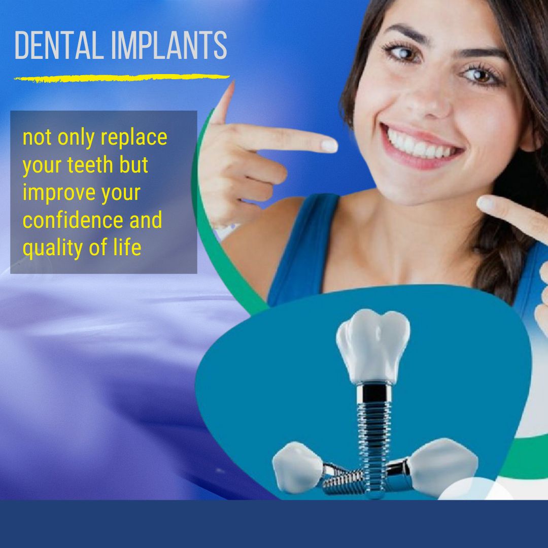 Conventional Dental Implants