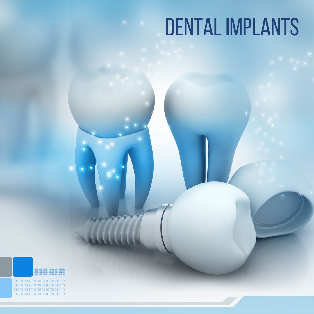 Conventional Dental Implants